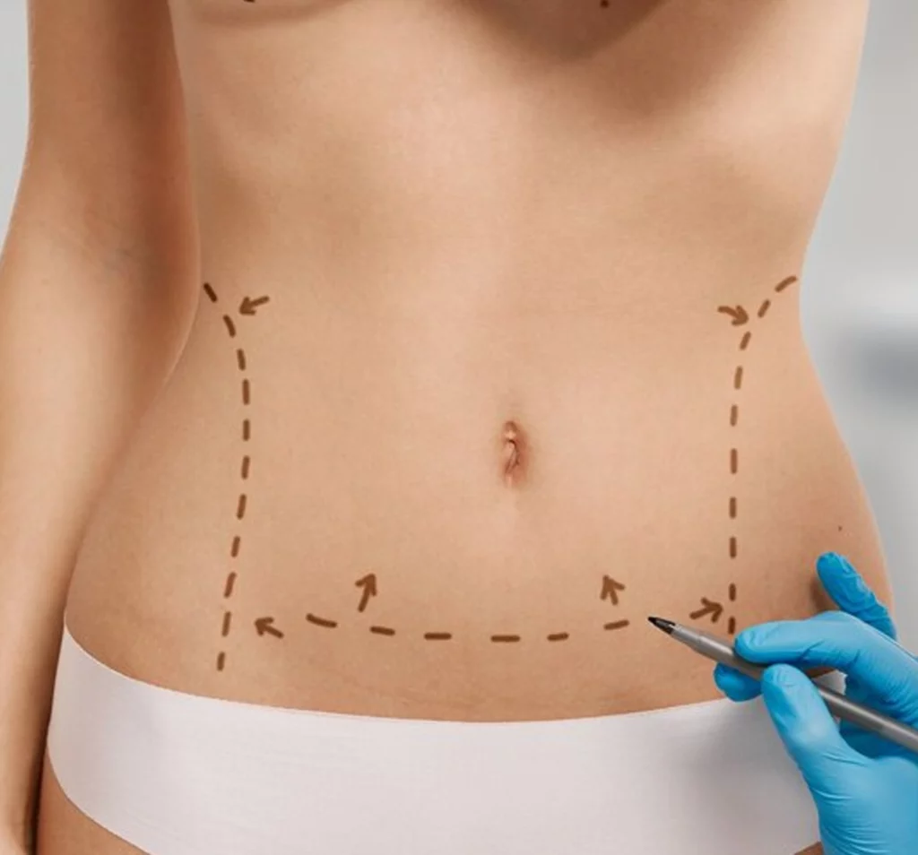 Tourisme médical en Tunisie - Afrik Services - Chirurgie esthétique