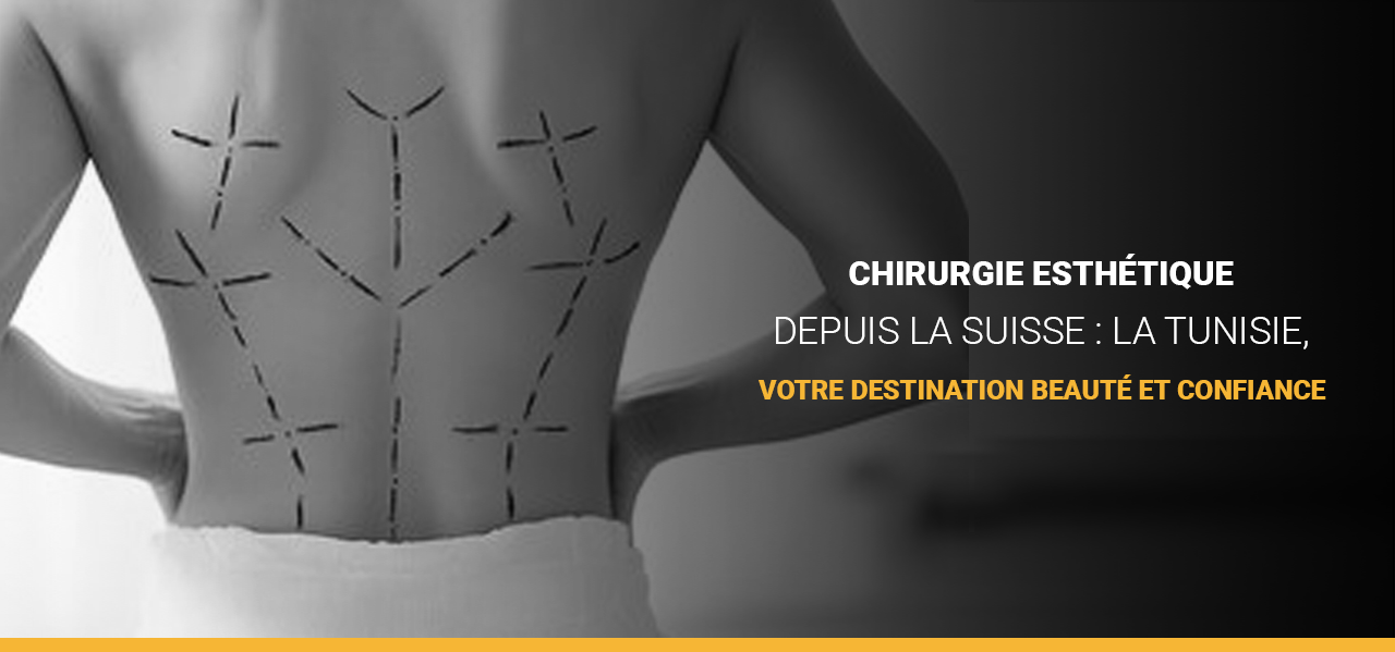 Chirurgie esthétique depuis la Suisse : la Tunisie, votre destination beauté et confiance