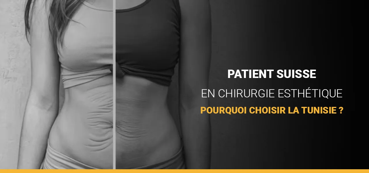 Patient suisse en chirurgie esthétique : pourquoi choisir la Tunisie ?